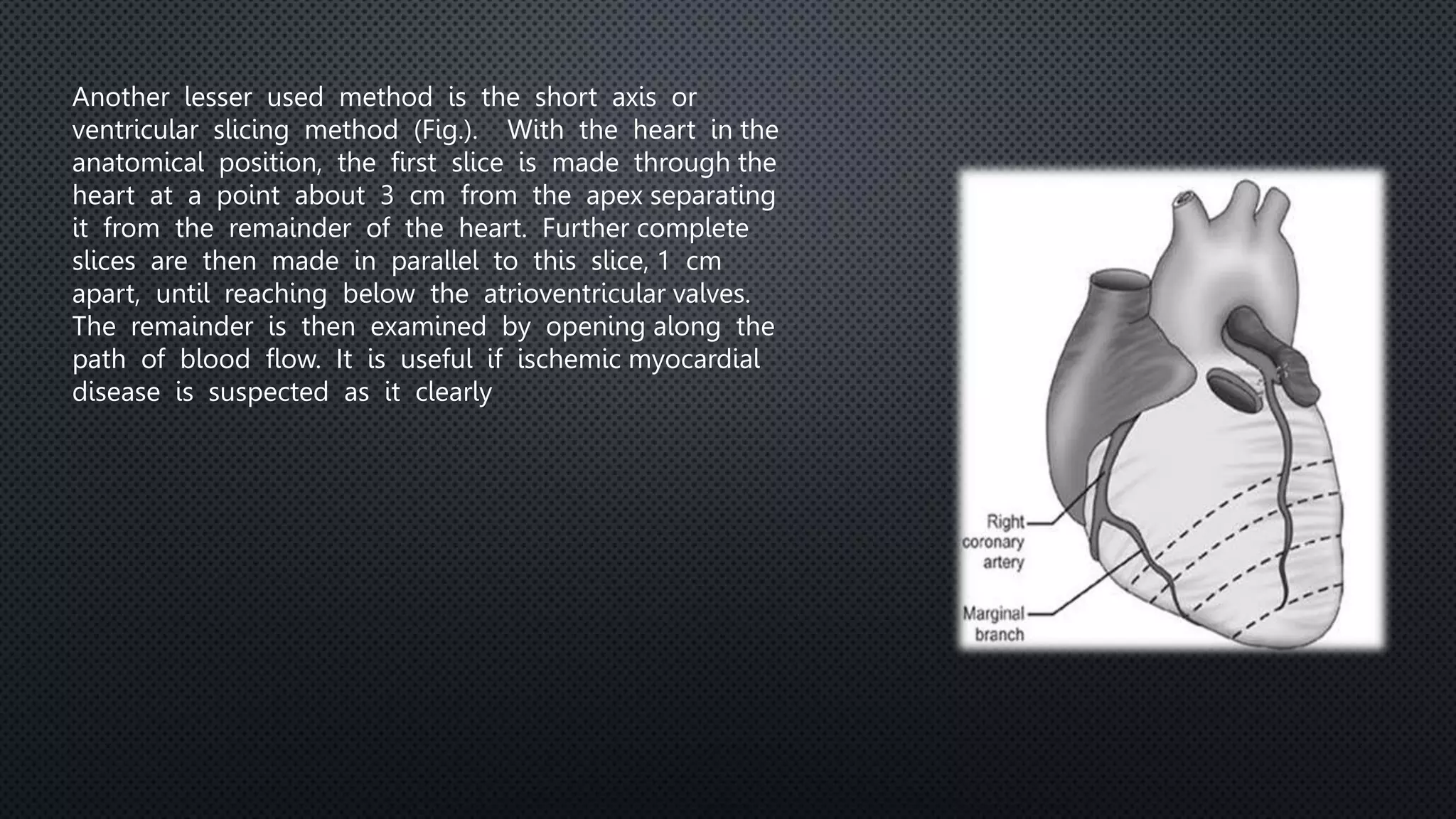 Procedure to Medico legal Autopsy.pptx