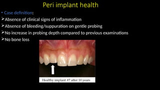 Proceedings of the world workshop on periodontal and [Autosaved].pptx