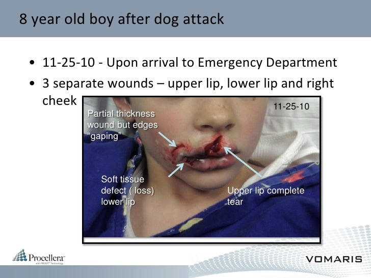 case study on dog bite