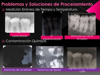 Procesamiento de la pélicula para radiografia dental | PPSX