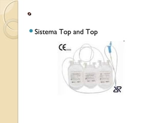 ºº
Sistema Top and Top
 