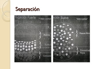 SeparaciónSeparación
 