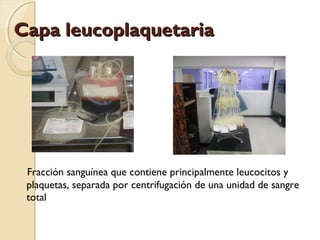 Capa leucoplaquetariaCapa leucoplaquetaria
Fracción sanguínea que contiene principalmente leucocitos y
plaquetas, separada por centrifugación de una unidad de sangre
total
 