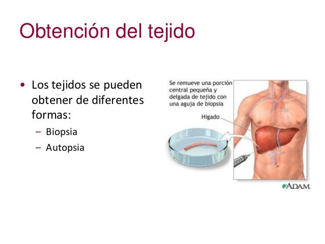 Obtención del tejido
• Los tejidos se pueden
obtener de diferentes
formas:
– Biopsia
– Autopsia
 