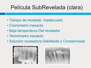 Procesamiento de película radiográfica | PPTX