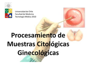 Universidad de Chile Facultad de Medicina Tecnología Médica 2010 Procesamiento de Muestras Citológicas Ginecológicas 