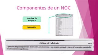 Componentes de un NOC
Nombre de
etiqueta
Definición
 