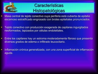 Características
Histopatológicas
 Masa central de tejido conectivo cuya periferia está cubierta de epitelio
escamoso estratificado engrosado con brotes epiteliales pronunciados.
 Tejido conectivo con producción exagerada de capilares ingurgitados
neoformados, tapizados por células endoteliales.
 Entre los capilares hay un estroma moderadamente fibroso que presenta
diversos grados de edema o infiltrado leucocitario.
 Inflamación crónica generalizada, con una zona superficial de inflamación
aguda.
 