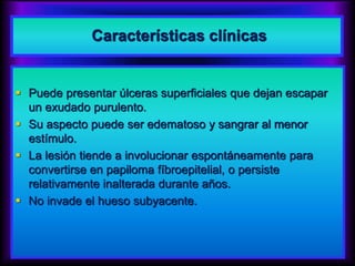 Características clínicas
 Puede presentar úlceras superficiales que dejan escapar
un exudado purulento.
 Su aspecto puede ser edematoso y sangrar al menor
estímulo.
 La lesión tiende a involucionar espontáneamente para
convertirse en papiloma fíbroepitelial, o persiste
relativamente inalterada durante años.
 No invade el hueso subyacente.
 
