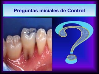 Preguntas iniciales de Control
 
