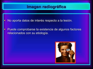  No aporta datos de interés respecto a la lesión.
 Puede comprobarse la existencia de algunos factores
relacionados con su etiología.
Imagen radiográfica
 