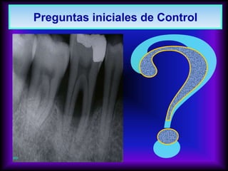 Preguntas iniciales de Control
 