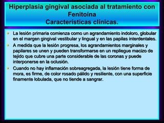  La lesión primaria comienza como un agrandamiento indoloro, globular
en el margen gingival vestibular y lingual y en las papilas interdentales.
 A medida que la lesión progresa, los agrandamientos marginales y
papilares se unen y pueden transformarse en un repliegue macizo de
tejido que cubre una parte considerable de las coronas y puede
interponerse en la oclusión.
 Cuando no hay inflamación sobreagregada, la lesión tiene forma de
mora, es firme, de color rosado pálido y resiliente, con una superficie
finamente lobulada, que no tiende a sangrar.
Hiperplasia gingival asociada al tratamiento con
Fenitoína
Características clínicas.
 