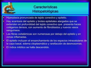 Características
Histopatológicas
 Hiperplasia pronunciada de tejido conectivo y epitelio.
 Hay acantosis del epitelio y brotes epiteliales alargados que se
extienden en profundidad del tejido conectivo que presenta haces
colágenos densos, con aumento de fibroblastos y nuevos vasos
sanguíneos.
 Las fibras oxitalámicas son numerosas por debajo del epitelio y en
zonas inflamadas.
 El epitelio incluyen el ensanchamiento de los espacios intracelulares de
la capa basal, edema citoplasmático y rarefacción de desmosomas.
 El índice mitótico se halla descendido.
 