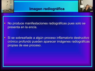 No produce manifestaciones radiográficas pues solo se
presenta en la encía.
 Si se sobreañade a algún proceso inflamatorio destructivo
crónico profundo pueden aparecer imágenes radiográficas
propias de ese proceso.
Imagen radiográfica
 