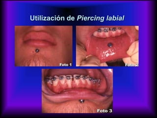 Utilización de Piercing labial
 
