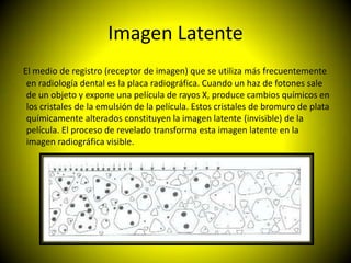Imagen Latente
El medio de registro (receptor de imagen) que se utiliza más frecuentemente
 en radiología dental es la placa radiográfica. Cuando un haz de fotones sale
 de un objeto y expone una película de rayos X, produce cambios químicos en
 los cristales de la emulsión de la película. Estos cristales de bromuro de plata
 químicamente alterados constituyen la imagen latente (invisible) de la
 película. El proceso de revelado transforma esta imagen latente en la
 imagen radiográfica visible.
 