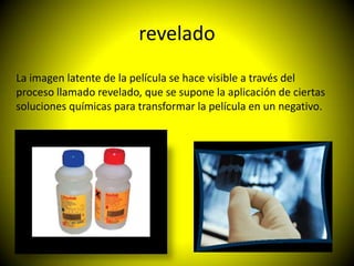 revelado
La imagen latente de la película se hace visible a través del
proceso llamado revelado, que se supone la aplicación de ciertas
soluciones químicas para transformar la película en un negativo.
 