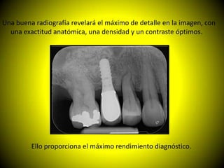 Una buena radiografía revelará el máximo de detalle en la imagen, con
  una exactitud anatómica, una densidad y un contraste óptimos.




         Ello proporciona el máximo rendimiento diagnóstico.
 