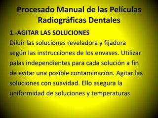 Procesado Manual de las Películas
       Radiográficas Dentales
1.-AGITAR LAS SOLUCIONES
Diluir las soluciones reveladora y fijadora
según las instrucciones de los envases. Utilizar
palas independientes para cada solución a fin
de evitar una posible contaminación. Agitar las
soluciones con suavidad. Ello asegura la
uniformidad de soluciones y temperaturas
 