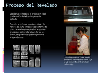 Proceso del Revelado
Esta solución reactiva el proceso iniciado
por la acción de la luz al exponer la
película.
Con ello se reducen más los cristales de
haluros de plata en los que se ha formado
plata de modo que se produzcan granos
gruesos de este metal alrededor de las
diminutas partículas que componen la
imagen latente.
Los Halogenuros de Plata Son los
elementos sensibles a los rayos X ya
la luz, contenidos en la emulsión
radiográfica
 