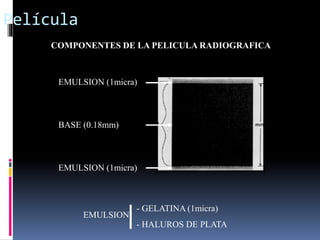 composici-n-de-pel-cula-radiogr-fica-pptx