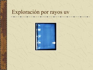 Exploración por rayos uv
 