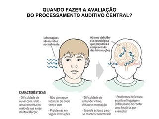 QUANDO FAZER A AVALIAÇÃO
DO PROCESSAMENTO AUDITIVO CENTRAL?
 