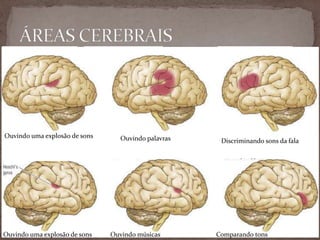 Ouvindo uma explosão de sons Ouvindo palavras Discriminando sons da fala
Ouvindo uma explosão de sons Ouvindo músicas Comparando tons
 