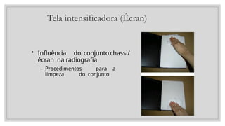 Tela intensificadora (Écran)
• Influência do conjuntochassi/
écran na radiografia
– Procedimentos para a
limpeza do conjunto
 