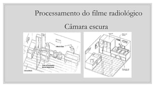 Processamento do filme radiológico
Câmara escura
 