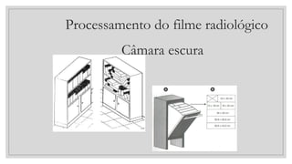 Processamento do filme radiológico
Câmara escura
 