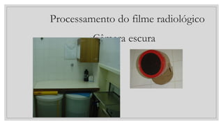 Processamento do filme radiológico
Câmara escura
 