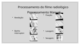 Processamento do filme radiológico
Processamento Manual
• Revelação:
• Banho
interruptor:
• Fixação:
•
• Lavagem:
Secagem:
 