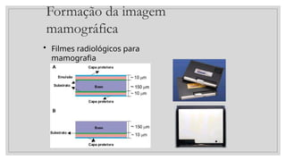 Formação da imagem
mamográfica
• Filmes radiológicos para
mamografia
 