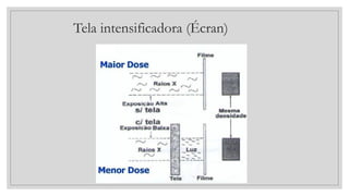 Tela intensificadora (Écran)
 