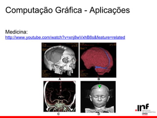 Computação Gráfica - Aplicações
Medicina:
http://www.youtube.com/watch?v=xnj8wVxhB8s&feature=related
 