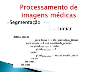  Segmentação
                Limiar
 