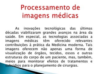 As inovações tecnológicas das últimas
décadas viabilizaram grandes avanços na área da
saúde. Em especial, as tecnologias associadas a
imagens médicas têm oferecido relevantes
contribuições à prática da Medicina moderna. Tais
imagens oferecem não apenas uma forma de
visualização de órgãos, tecidos, ossos e outras
estruturas do corpo de um paciente, mas, também,
meios para monitorar efeitos de tratamentos e
subsídios para o planejamento de cirurgias.
 
