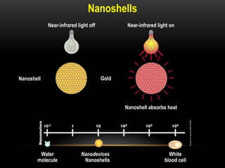 Nanoshells
Nanoshell
White
blood cell
Water
molecule
Nanodevices
Nanoshells
Gold
Near-infrared light onNear-infrared light off
Nanoshell absorbs heat
 