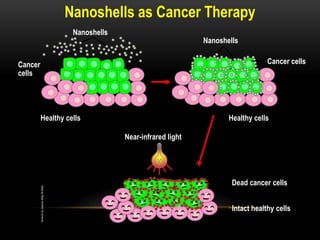 Nanoshells as Cancer Therapy
Nanoshells
Dead cancer cells
Nanoshells
Cancer
cells
Healthy cells
Intact healthy cells
Near-infrared light
Healthy cells
Cancer cells
 