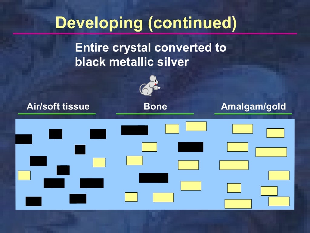 Dental Film Processing
