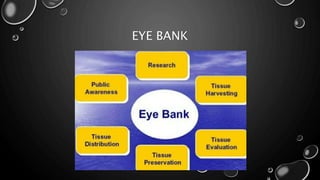 EYE BANK
 