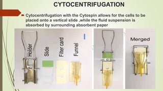CYTOCENTRIFUGATION
 Cytocentrifugation with the Cytospin allows for the cells to be
placed onto a vertical slide ,while the fluid suspension is
absorbed by surrounding absorbent paper
 