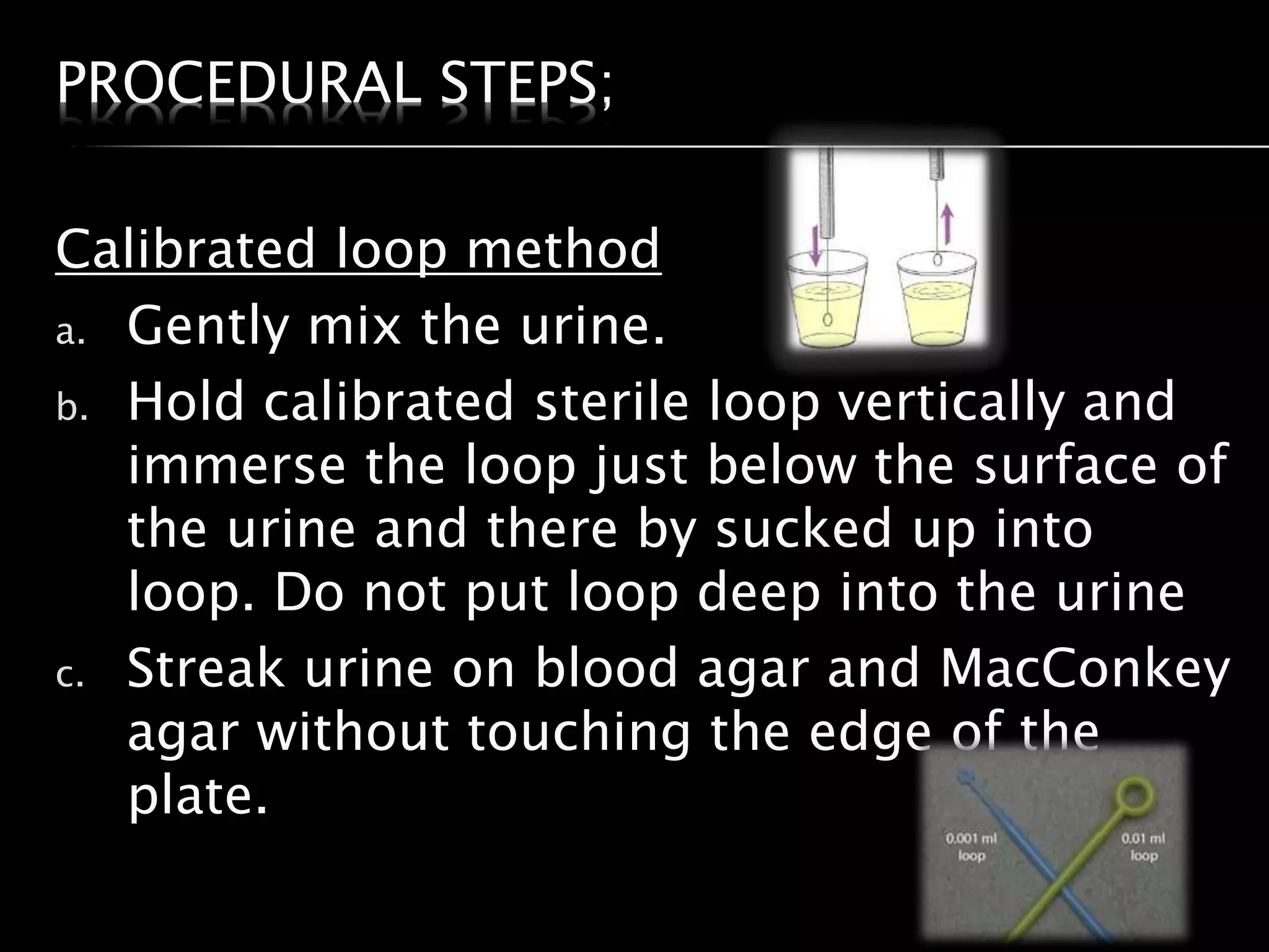 Loopful Processing of urine in microbiology by Rahul raj | PPTX