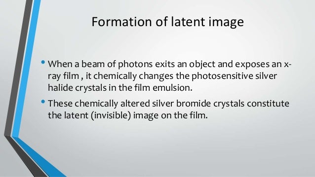 Processing Of X Ray Film