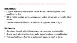 Are Rocks Radiopaque PROCESSING OF XRAY FILM, THE STEPS UNDER THE PROCEDURE | PPTX