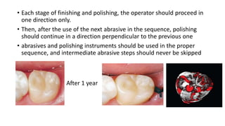 • Each stage of finishing and polishing, the operator should proceed in
one direction only.
• Then, after the use of the next abrasive in the sequence, polishing
should continue in a direction perpendicular to the previous one
• abrasives and polishing instruments should be used in the proper
sequence, and intermediate abrasive steps should never be skipped
After 1 year
 
