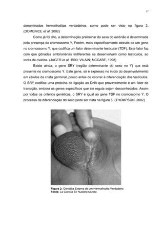 17




denominados hermafroditas verdadeiros, como pode ser visto na figura 2.
(DOMENICE et al, 2002)
      Como já foi dito, a determinação preliminar do sexo do embrião é determinada
pela presença do cromossomo Y. Porém, mais especificamente através de um gene
no cromossomo Y, que codifica um fator determinante testicular (TDF). Este fator faz
com que gônadas embrionárias indiferentes se desenvolvam como testículos, ao
invés de ovários. (JAGER et al, 1990; VILAIN; MCCABE, 1998)
      Existe ainda, o gene SRY (região determinante do sexo no Y) que está
presente no cromossomo Y. Este gene, só é expresso no início do desenvolvimento
em células da crista germinal, pouco antes de ocorrer à diferenciação dos testículos.
O SRY codifica uma proteína de ligação ao DNA que provavelmente é um fator de
transição, embora os genes específicos que ele regula sejam desconhecidos. Assim
por todos os critérios genéticos, o SRY é igual ao gene TDF no cromossomo Y. O
processo de diferenciação do sexo pode ser vista na figura 3. (THOMPSON, 2002)




                  Figura 2: Genitália Externa de um Hermafrodita Verdadeiro
                  Fonte: La Ciencia En Nuestro Mundo
 