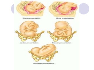 process of Normal labor (1).ppt
